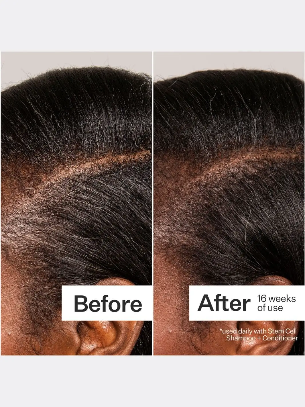 3% Stem Cell Peptide Treatment - Image 2