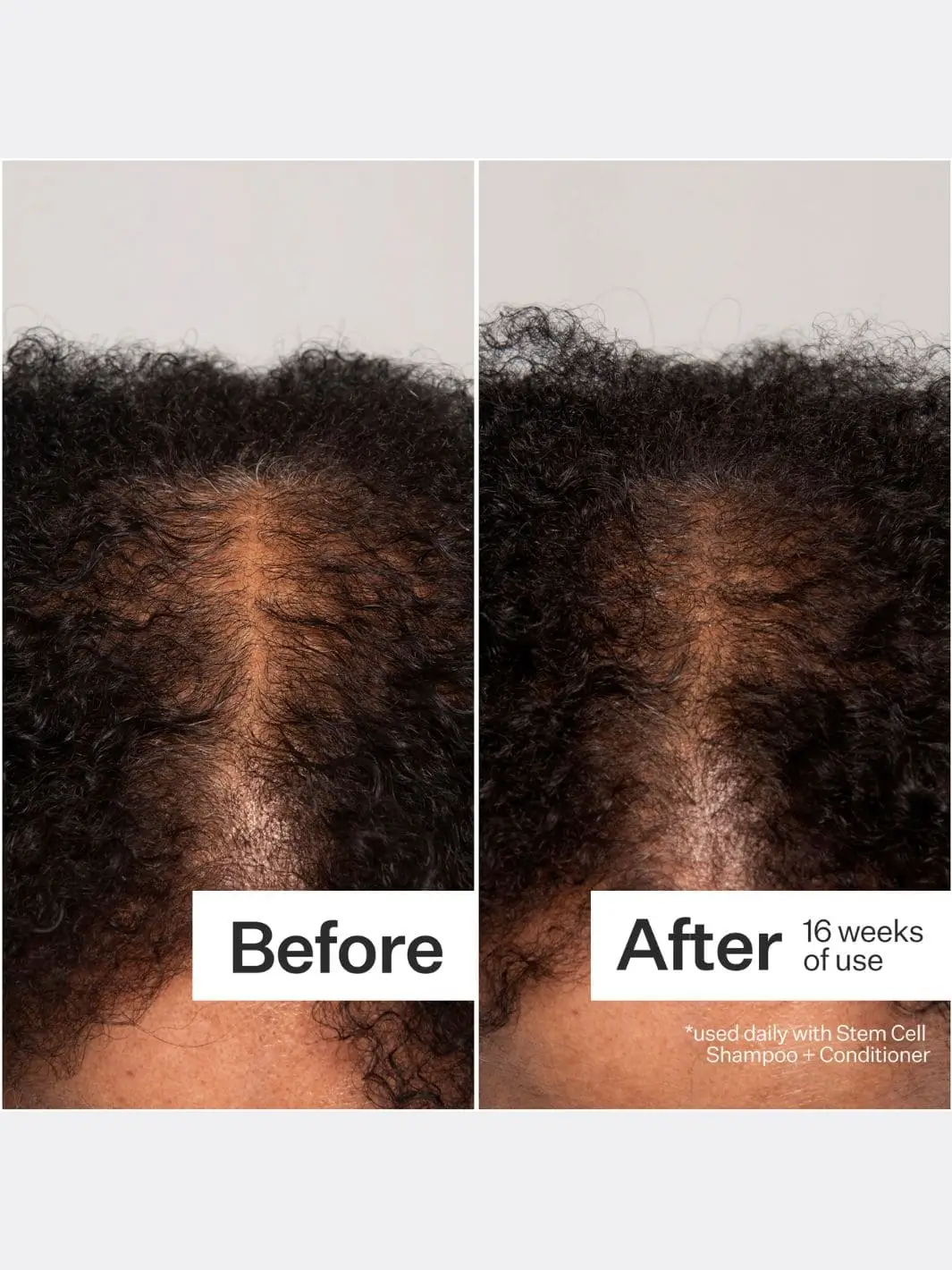 3% Stem Cell Peptide Treatment - Image 9