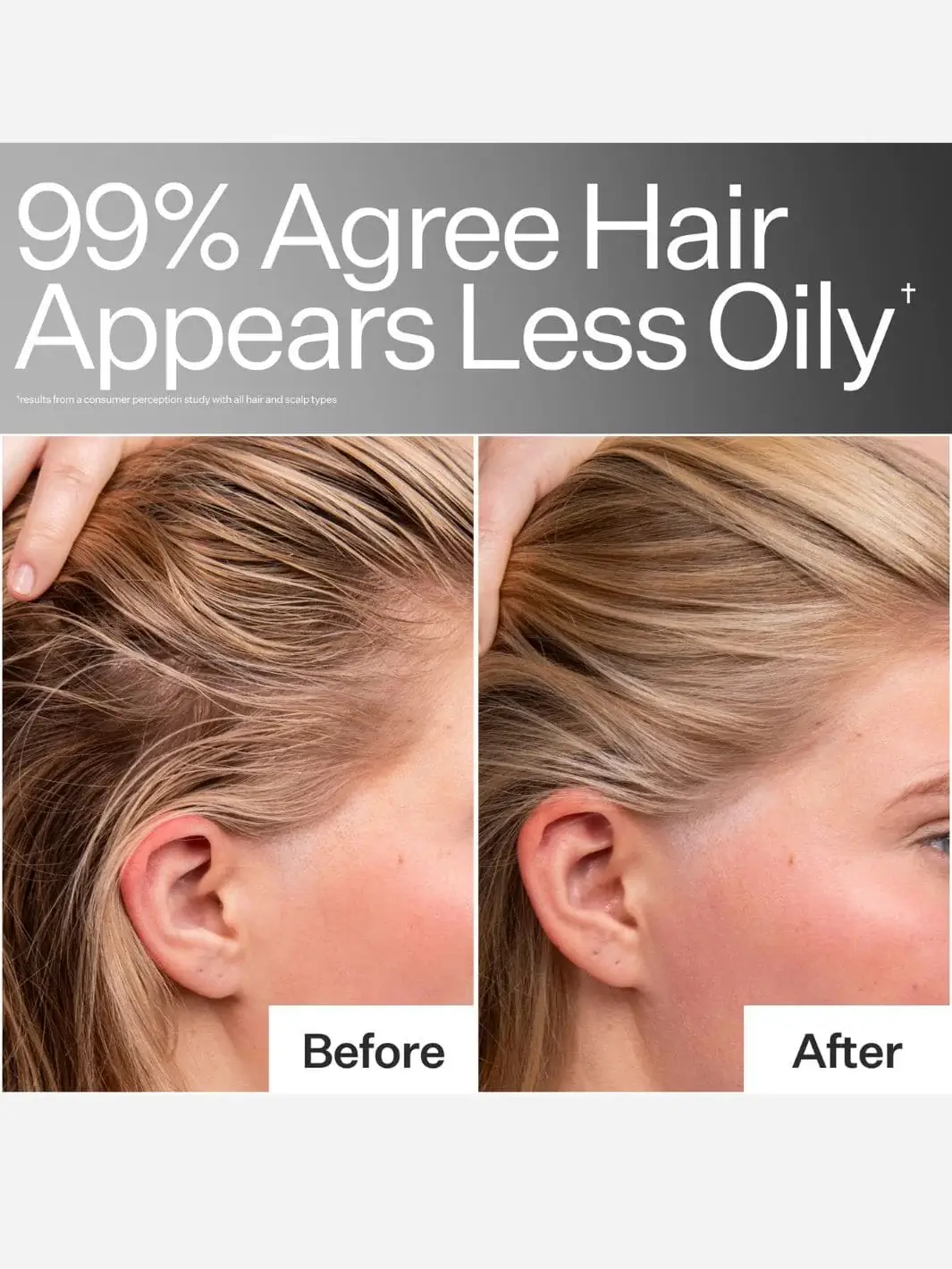 4% Niacinamide Oily Scalp Serum - Image 2