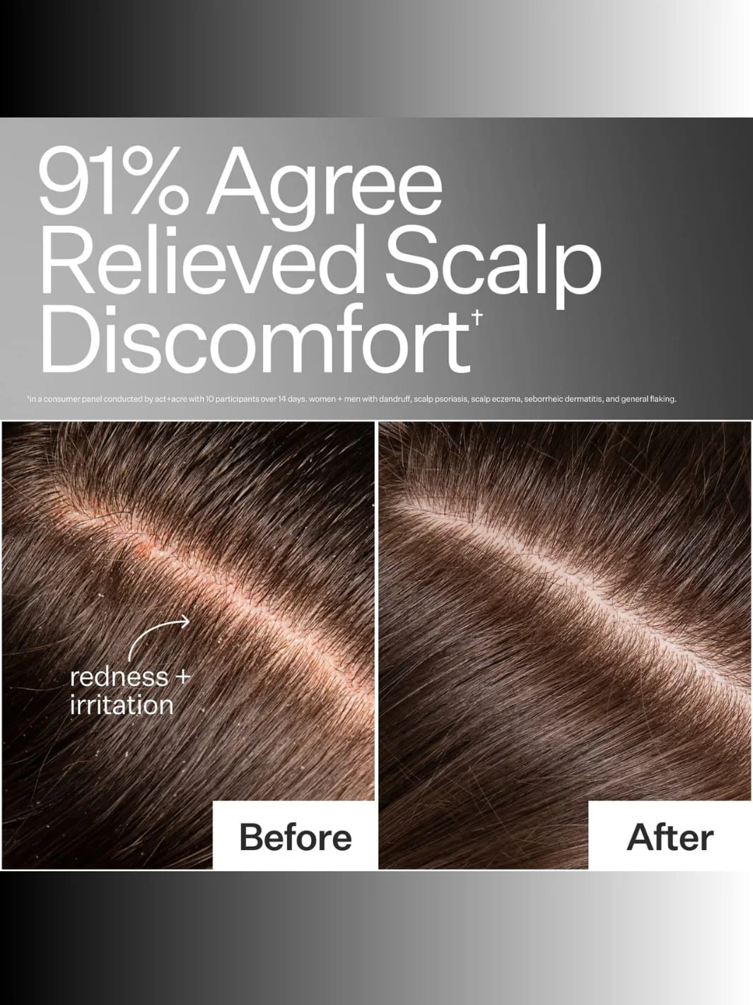 Instant Scalp Relief Pro System - Image 2