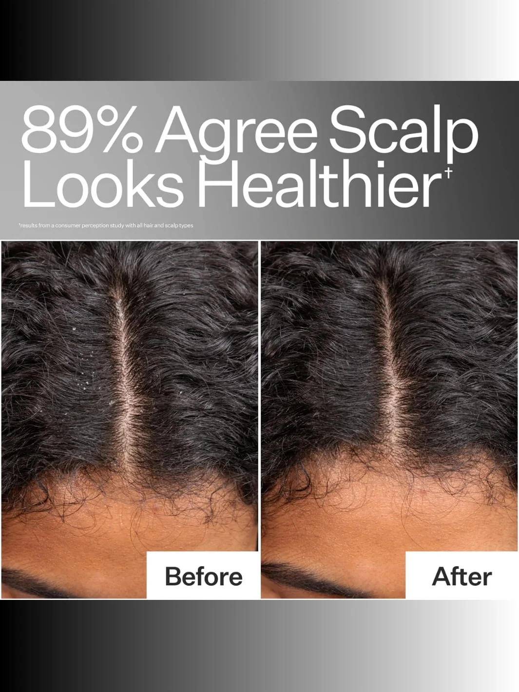 Instant Scalp Relief Pro System - Image 3