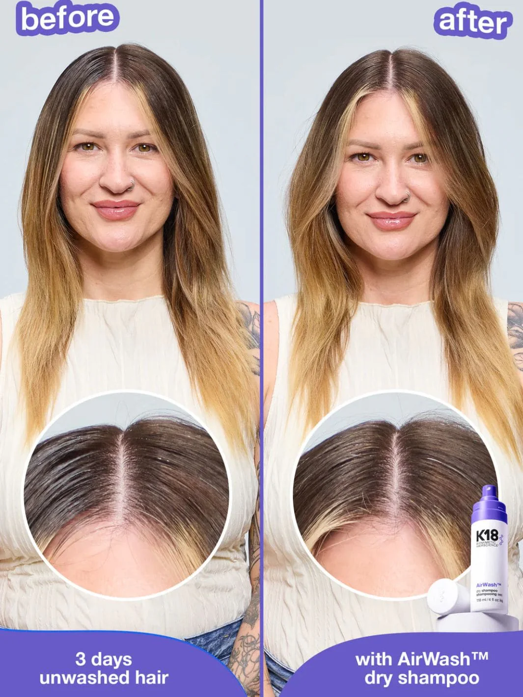 AirWash™ Dry Shampoo - Image 10