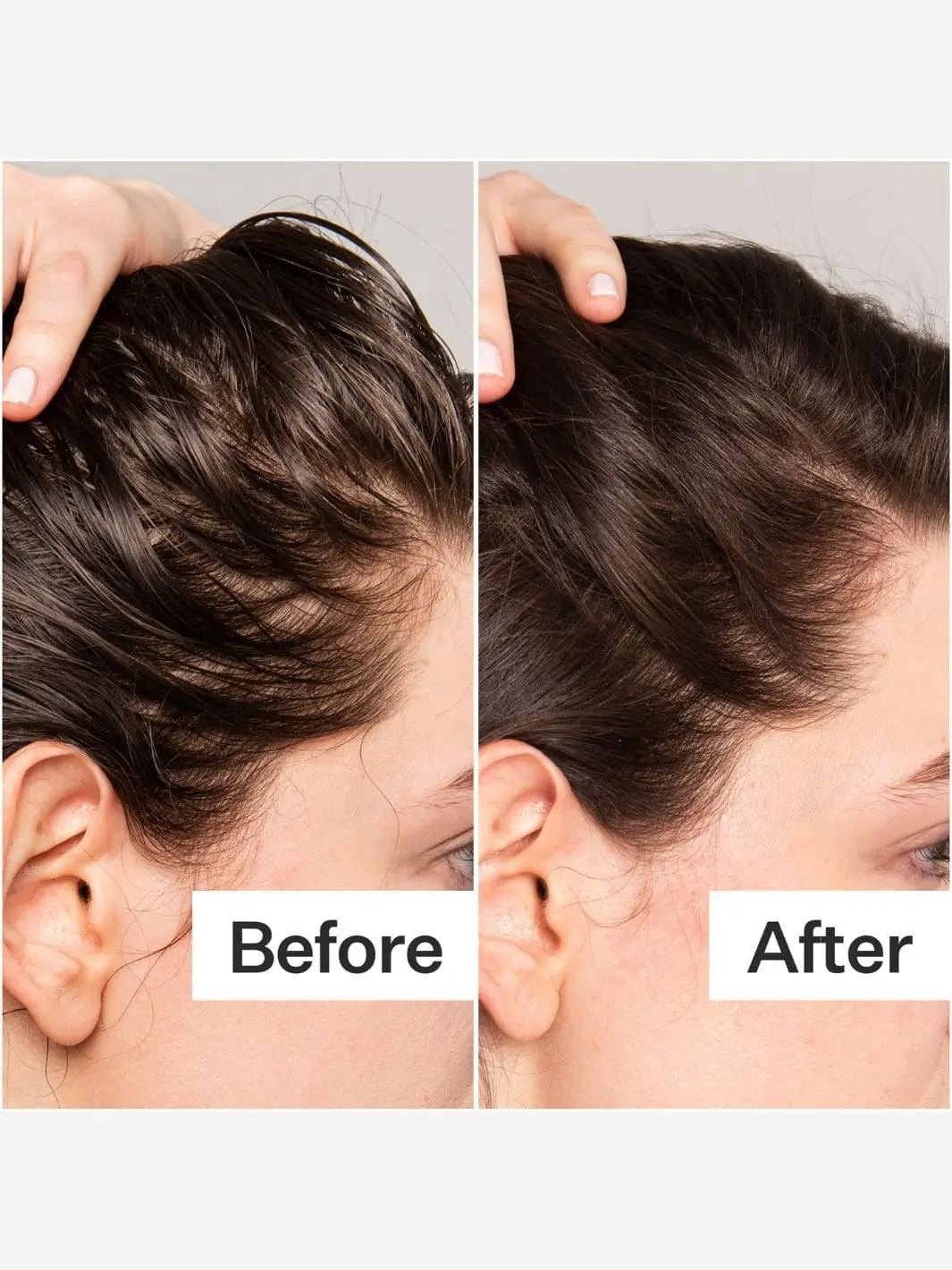 BHA Salicylic Acid Scalp Exfoliator (Scalp Renew) - Image 6