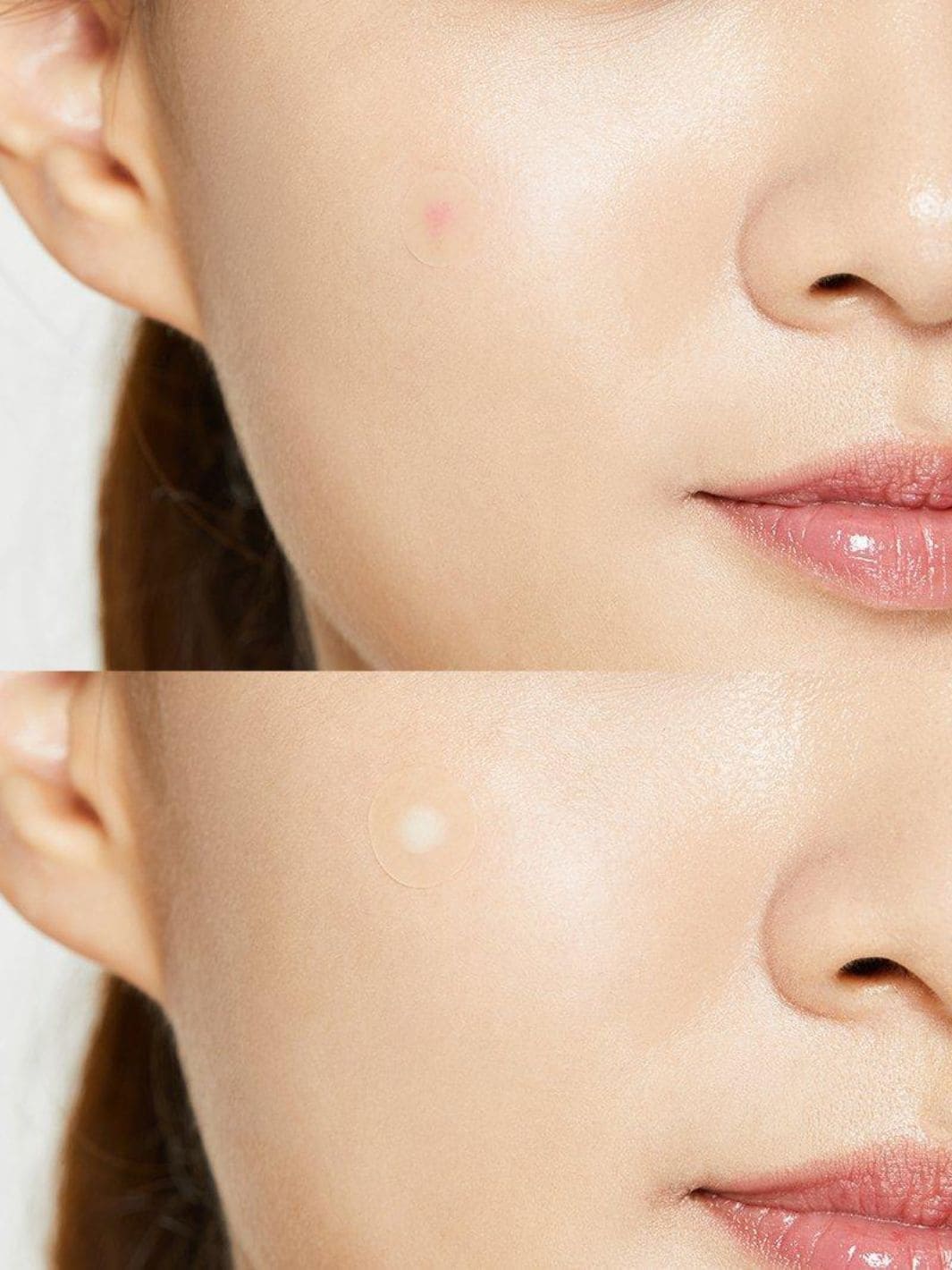 COSRX Acne Pimple Master - Image 5