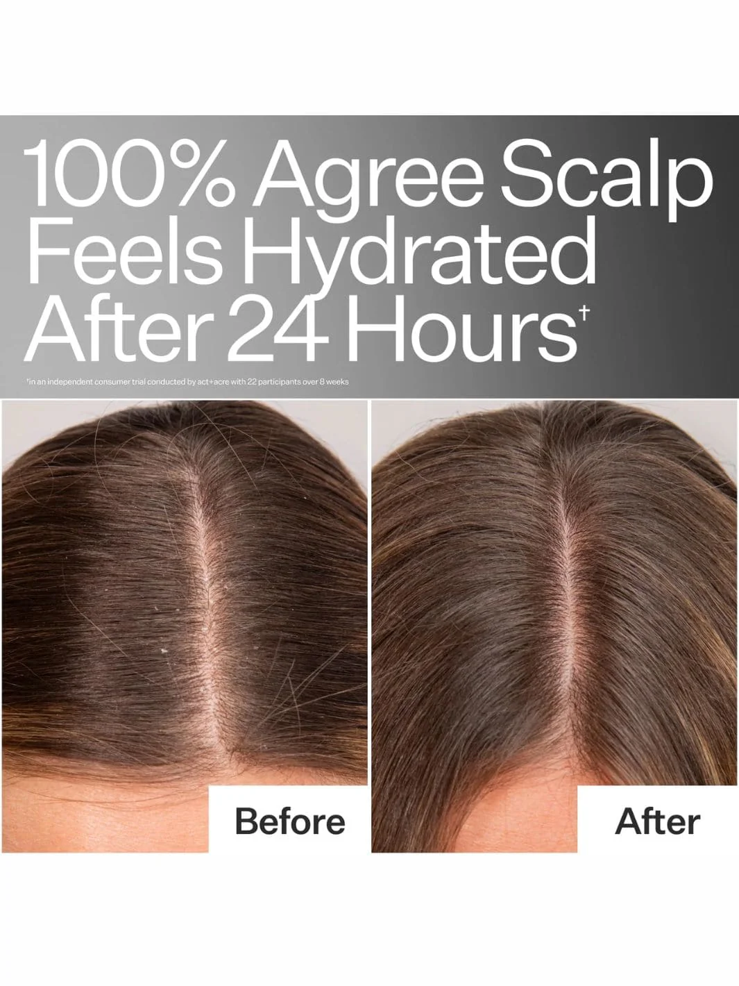 Daily Hydro™ Scalp Serum - Image 6