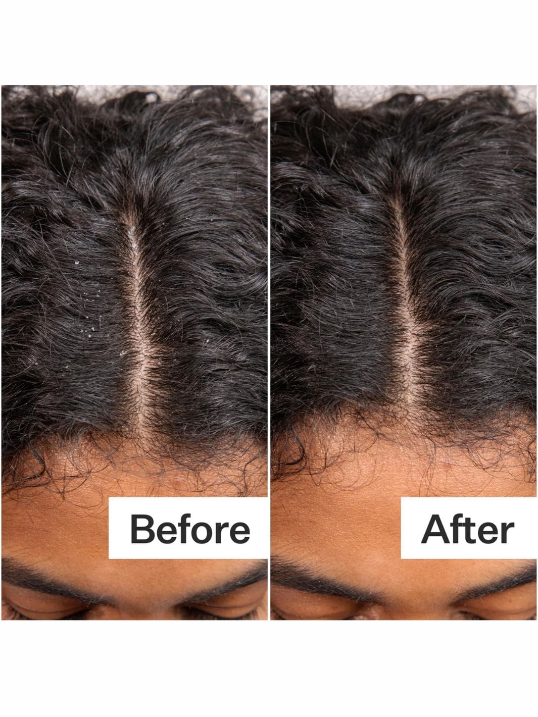 Daily Hydro™ Scalp Serum - Image 9