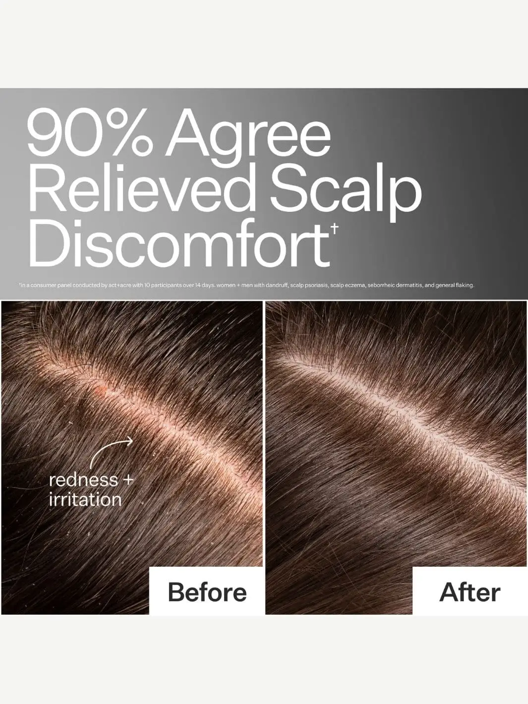 Microbiome Cooling Scalp Serum - Image 6
