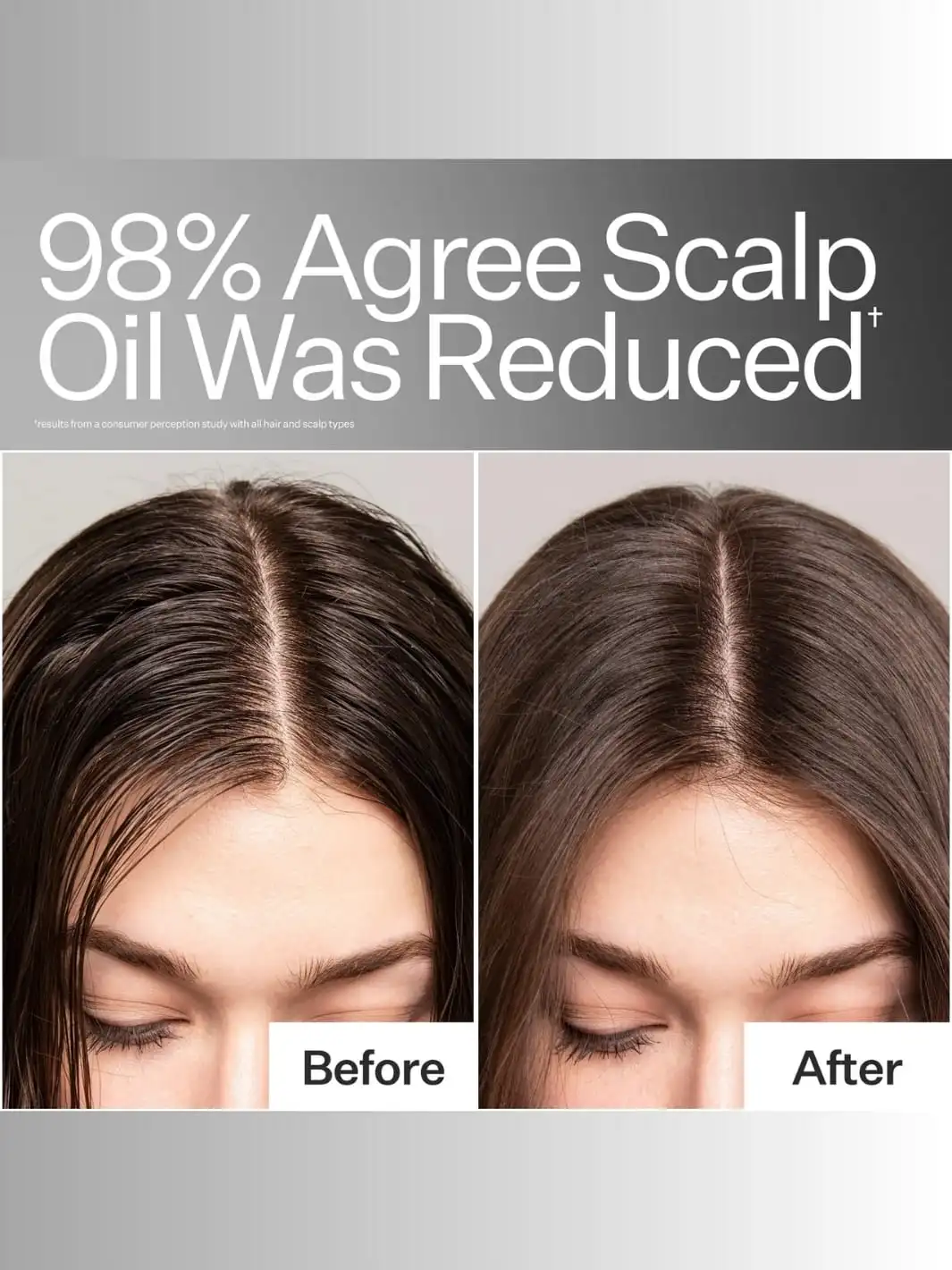 Oil Control Pro System - Image 7