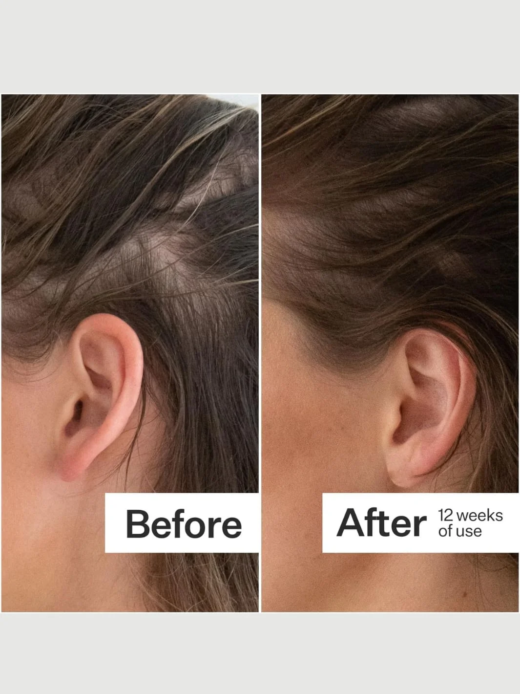 Plant Based Hair Capsules - Image 3