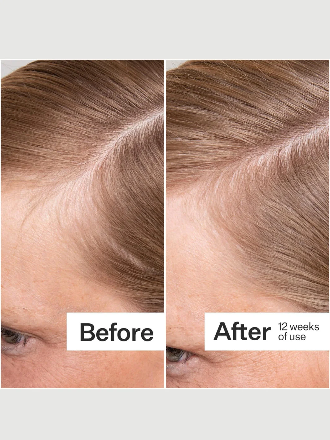 Plant Based Hair Capsules - Image 4