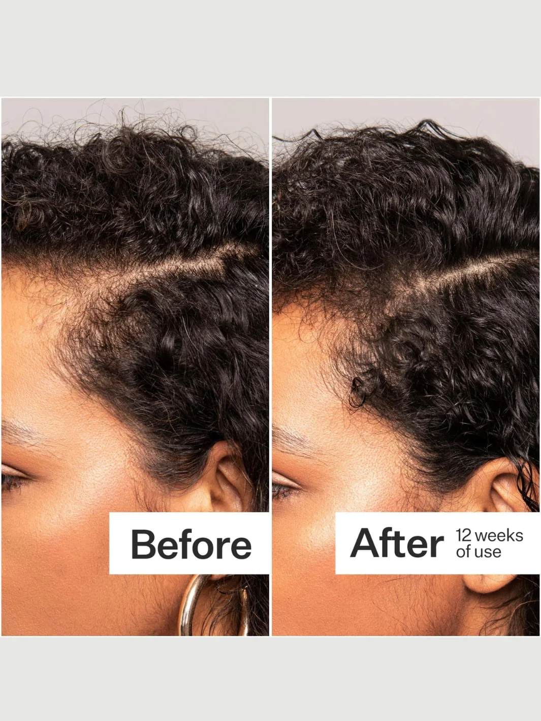 Plant Based Hair Capsules - Image 5