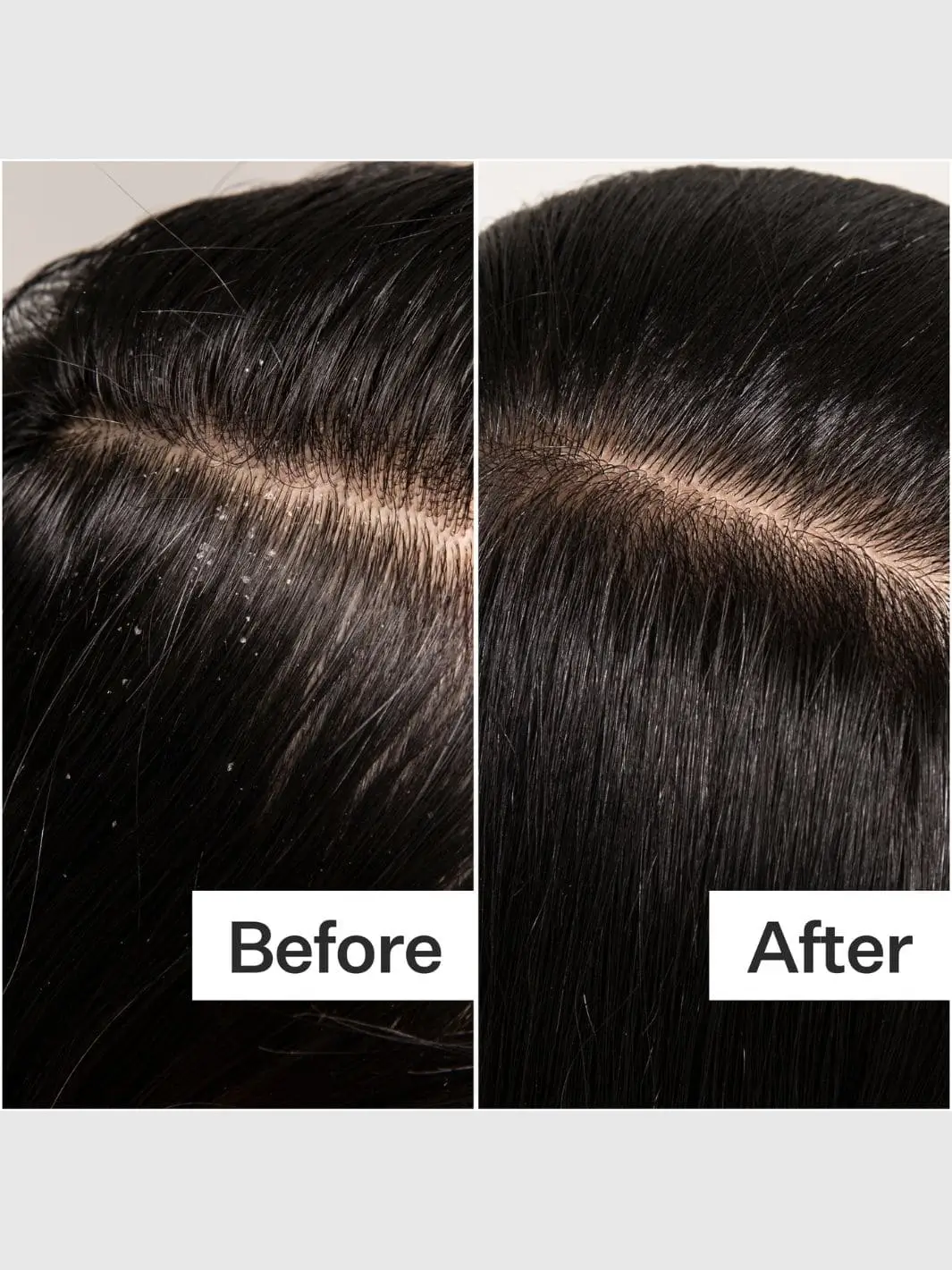 Vitamin E Scalp Detox Oil - Image 5